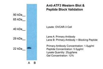 ATF3 Rabbit Polyclonal Antibody