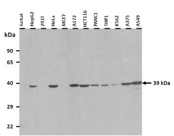 ANXA1 Rabbit Polyclonal Antibody