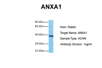 ANXA1 Rabbit Polyclonal Antibody