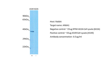 ANXA1 Rabbit Polyclonal Antibody