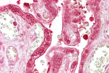 ANXA1 Rabbit Polyclonal Antibody