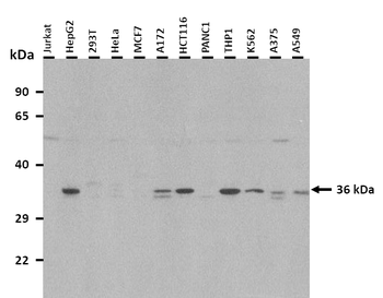 ANXA3 Rabbit Polyclonal Antibody