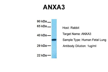 ANXA3 Rabbit Polyclonal Antibody