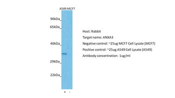 ANXA3 Rabbit Polyclonal Antibody
