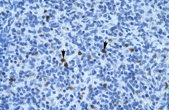 ANXA3 Rabbit Polyclonal Antibody