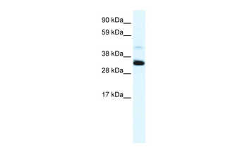 ANXA3 Rabbit Polyclonal Antibody