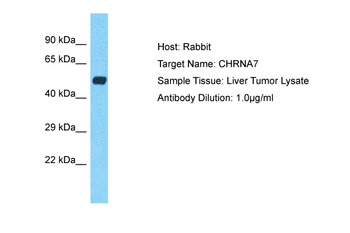 CHRNA7 Rabbit Polyclonal Antibody