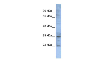 GJB1 Rabbit Polyclonal Antibody