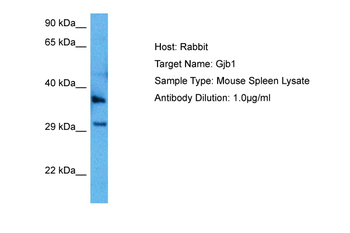 GJB1 Rabbit Polyclonal Antibody
