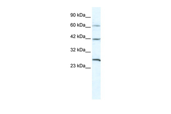 GJC1 Rabbit Polyclonal Antibody