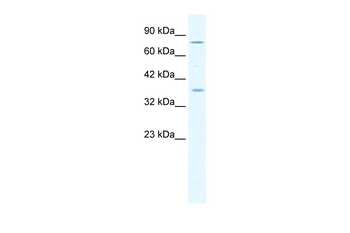 MCM4 Rabbit Polyclonal Antibody