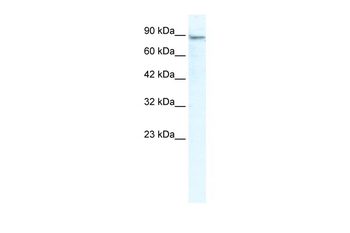 MCM4 Rabbit Polyclonal Antibody