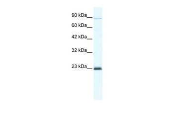 MCM4 Rabbit Polyclonal Antibody