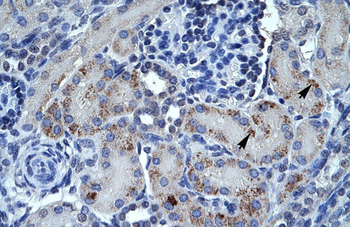 SPP1 Rabbit Polyclonal Antibody