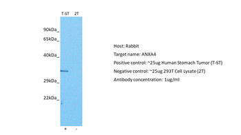 ANXA4 Rabbit Polyclonal Antibody