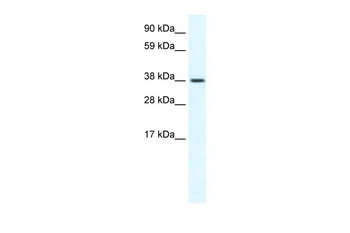 TRPM3 Rabbit Polyclonal Antibody