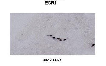 Egr1 Rabbit Polyclonal Antibody