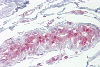 Ehf Rabbit Polyclonal Antibody