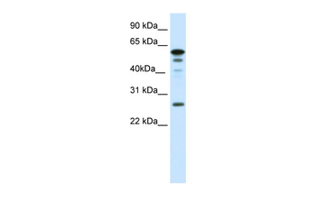 FOXD1 Rabbit Polyclonal Antibody