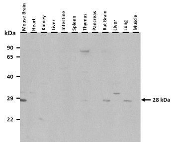 ASCL2 Rabbit Polyclonal Antibody
