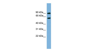 Nab2 Rabbit Polyclonal Antibody