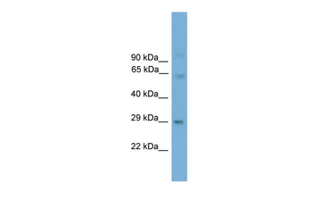 Prrx2 Rabbit Polyclonal Antibody