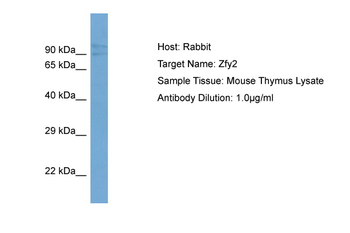 Zfy2 Rabbit Polyclonal Antibody