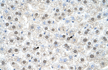 NR1I3 Rabbit Polyclonal Antibody
