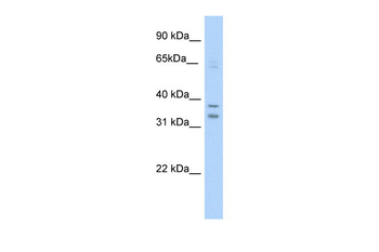 NR1I3 Rabbit Polyclonal Antibody