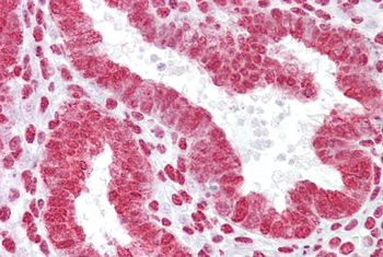 HOXA11 Rabbit Polyclonal Antibody
