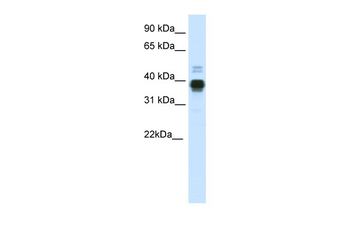 HOXA11 Rabbit Polyclonal Antibody