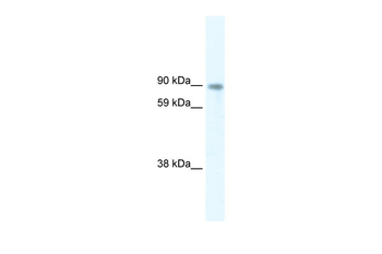 STAT5B Rabbit Polyclonal Antibody