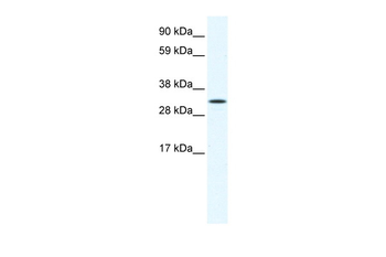 AIP Rabbit Polyclonal Antibody