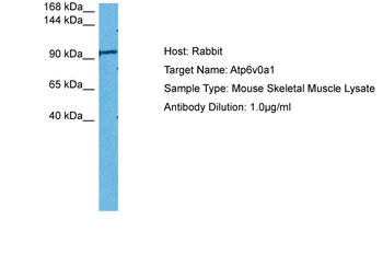 Atp6v0a1 Rabbit Polyclonal Antibody