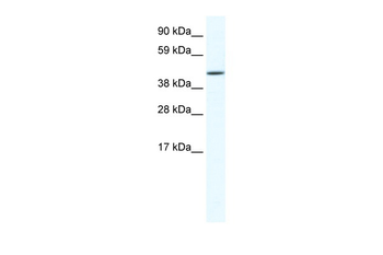 RUNX3 Rabbit Polyclonal Antibody
