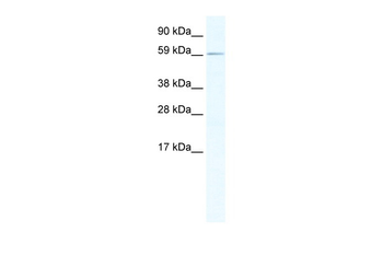 RBM14 Rabbit Polyclonal Antibody