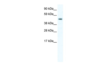 ELP4 Rabbit Polyclonal Antibody