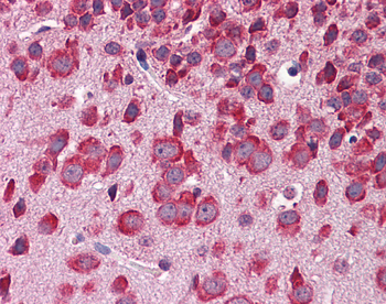 Fbxw7 Rabbit Polyclonal Antibody