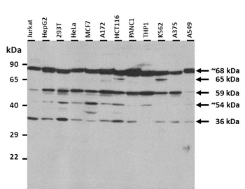 GPC3 Rabbit Polyclonal Antibody