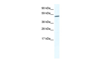 GPC3 Rabbit Polyclonal Antibody
