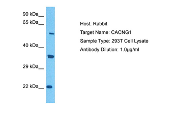 CACNG1 Rabbit Polyclonal Antibody