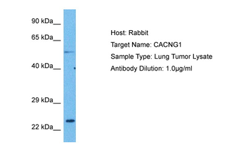 CACNG1 Rabbit Polyclonal Antibody