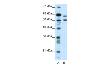 KCNK5 Rabbit Polyclonal Antibody