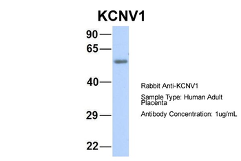 KCNV1 Rabbit Polyclonal Antibody