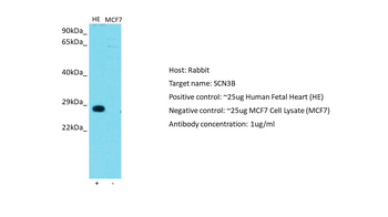 SCN3B Rabbit Polyclonal Antibody