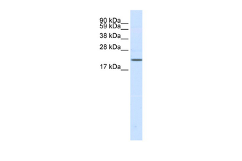 SCN3B Rabbit Polyclonal Antibody