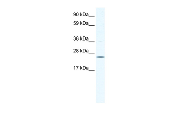 KCTD6 Rabbit Polyclonal Antibody