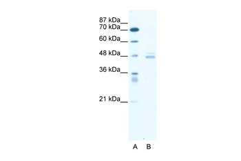 LDB1 Rabbit Polyclonal Antibody