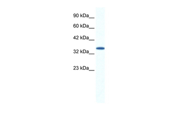 AIP Rabbit Polyclonal Antibody