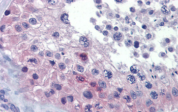 RHOXF2 Rabbit Polyclonal Antibody